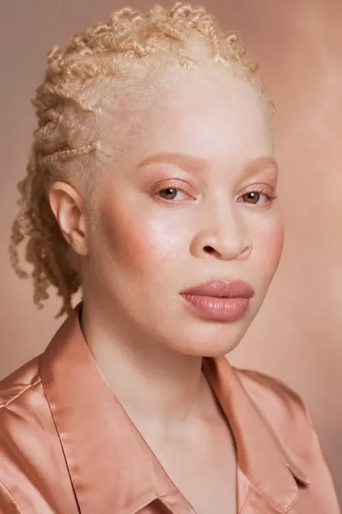 Rose Gold Makeup on Skin with Albinism